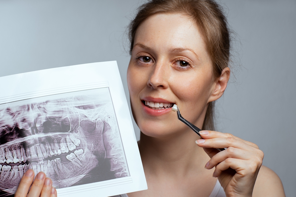 Crowns & Bridges in Cedar Hills, UT. Dr. Brian E. Isaacson, DMD. Cedar Hills Family Dentistry